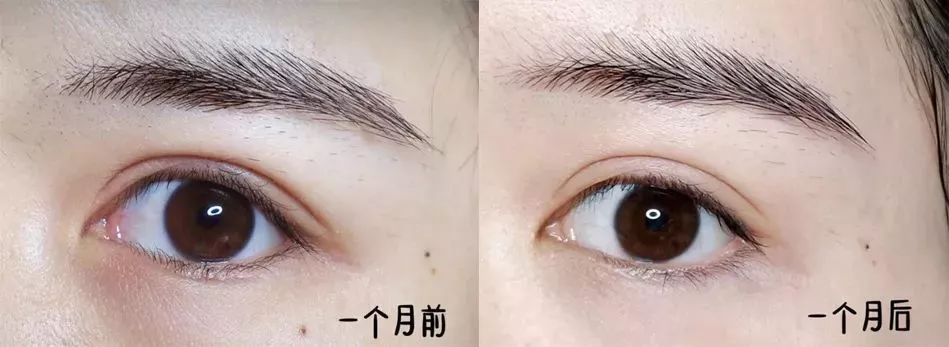 玻尿酸睡眠眼罩,日本去黑眼圈最好的产品