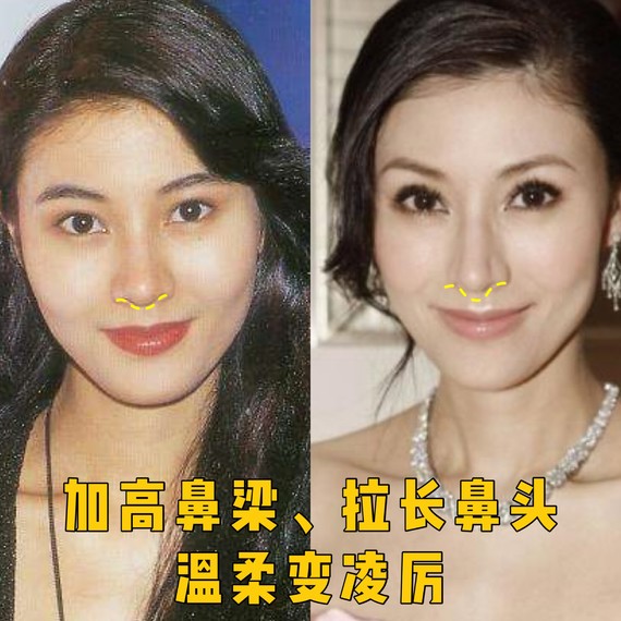 好看的鼻子类型驼峰鼻,好看的鼻型有哪几种