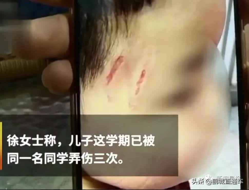 孩子在学校被欺负了应该怎么办?该打回去吗?专家教你这样做