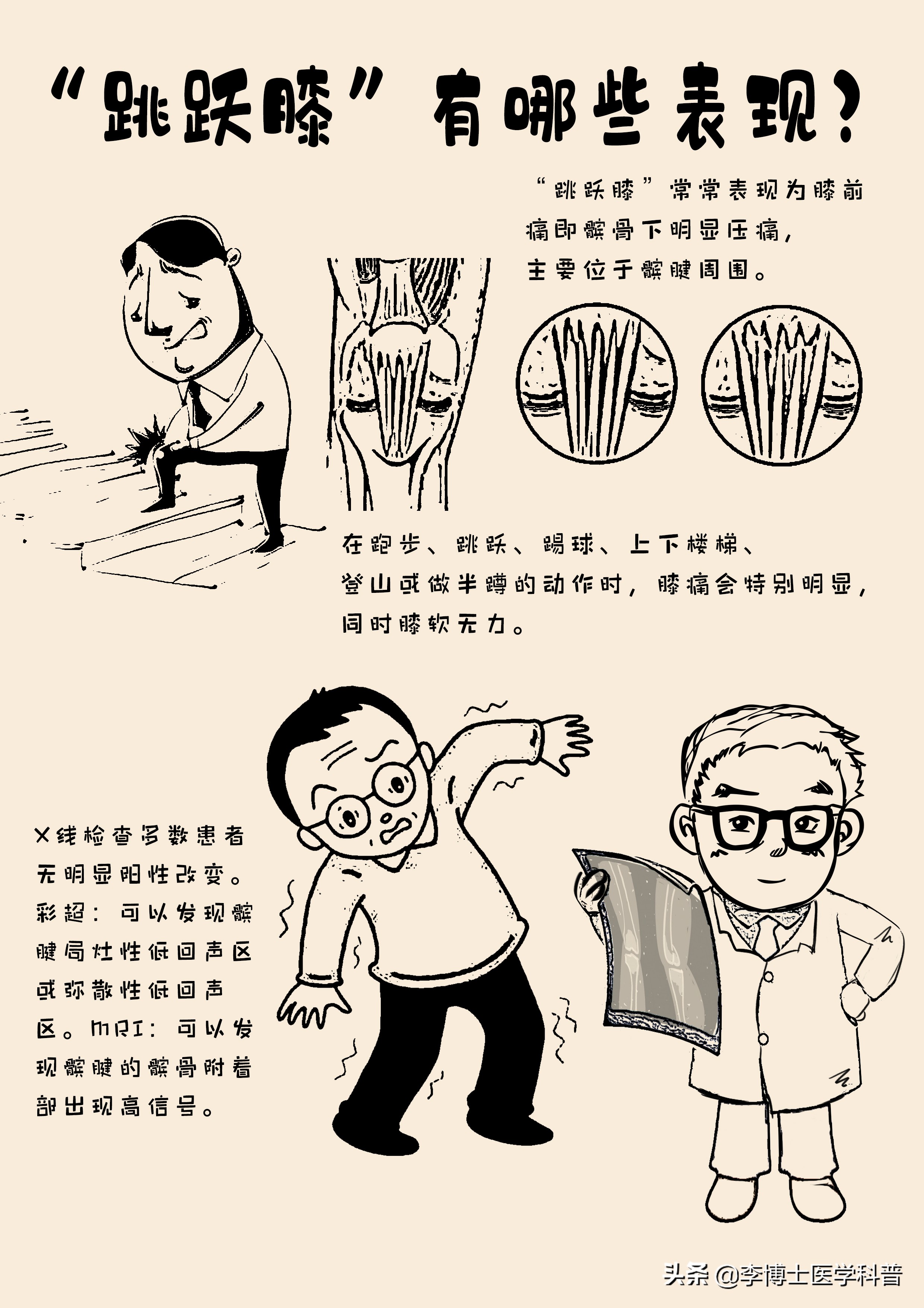 膝关节疼痛是关节炎吗,膝盖疼痛是不是髌腱炎