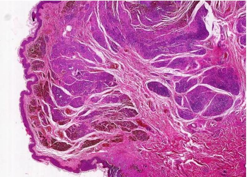 显微镜下的万花世界——走进病理学