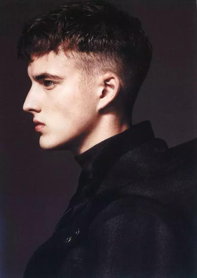 暗疮没有脓头怎么办,暗疮是不是不应该挤掉