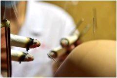 女性妇科疾病灸法,所有妇科问题