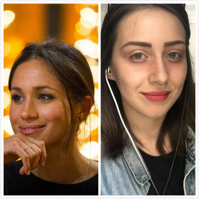 梅根福克斯素颜雀斑,英国女子患罕见疾病毁容