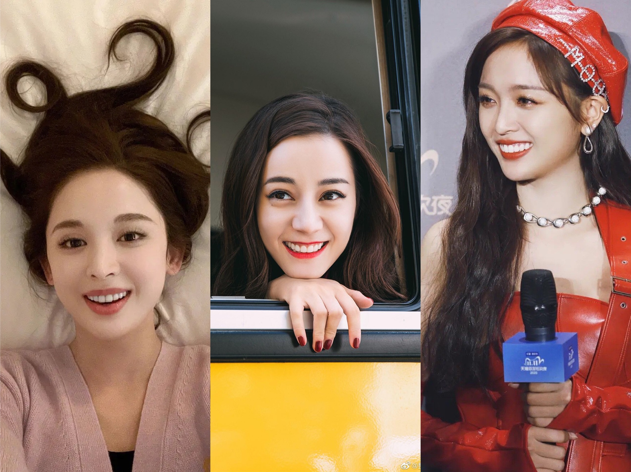 娜扎整牙后的样子,娜扎整牙前照片