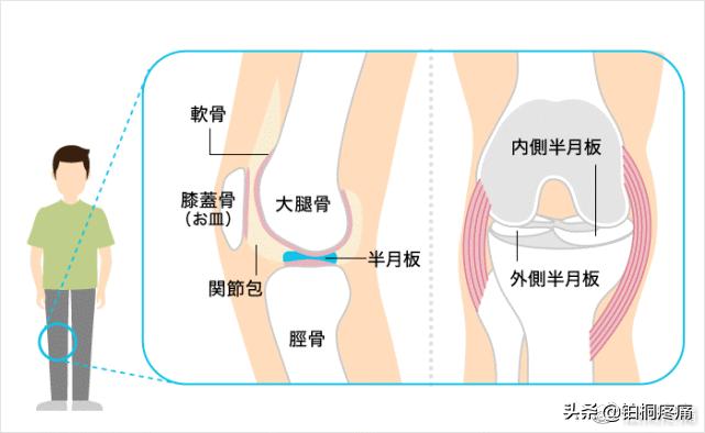 半月板受损怎么办,半月板受损是不是膝盖伸不直
