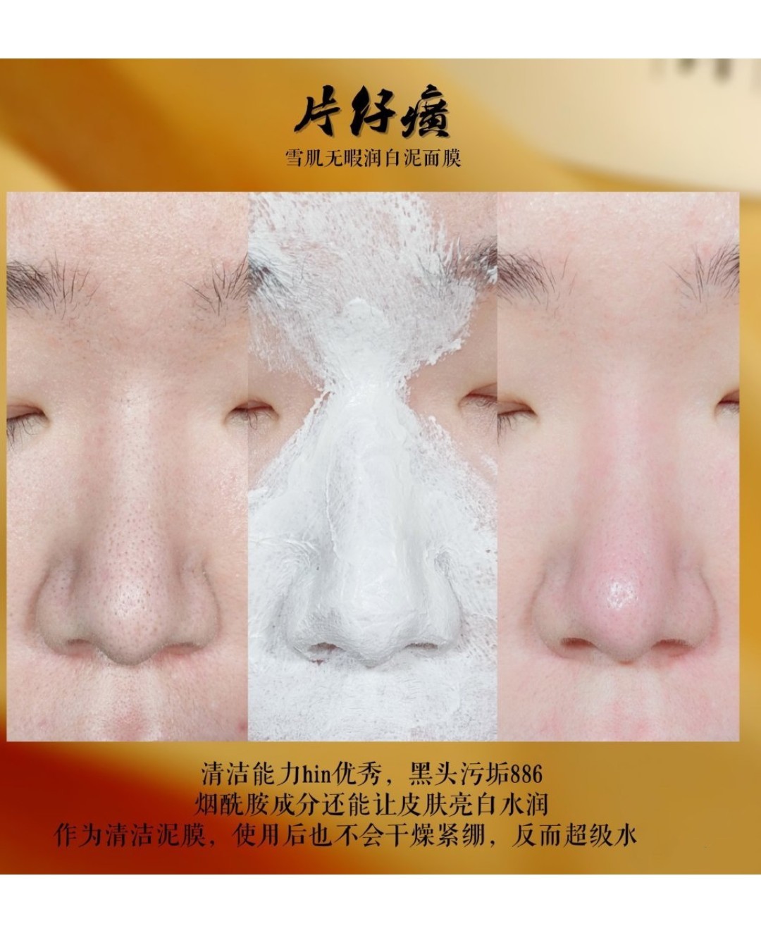 片仔癀雪肌无暇润白泥面膜好用吗,夏天到了护肤要素