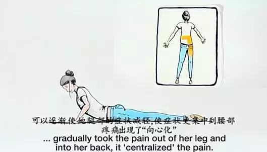 麦肯基，世界公认治疗腰痛的经典方法
