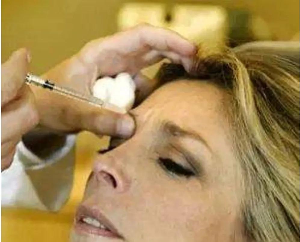 医疗美容去斑做什么项目最好,过年必做的4个医美项目