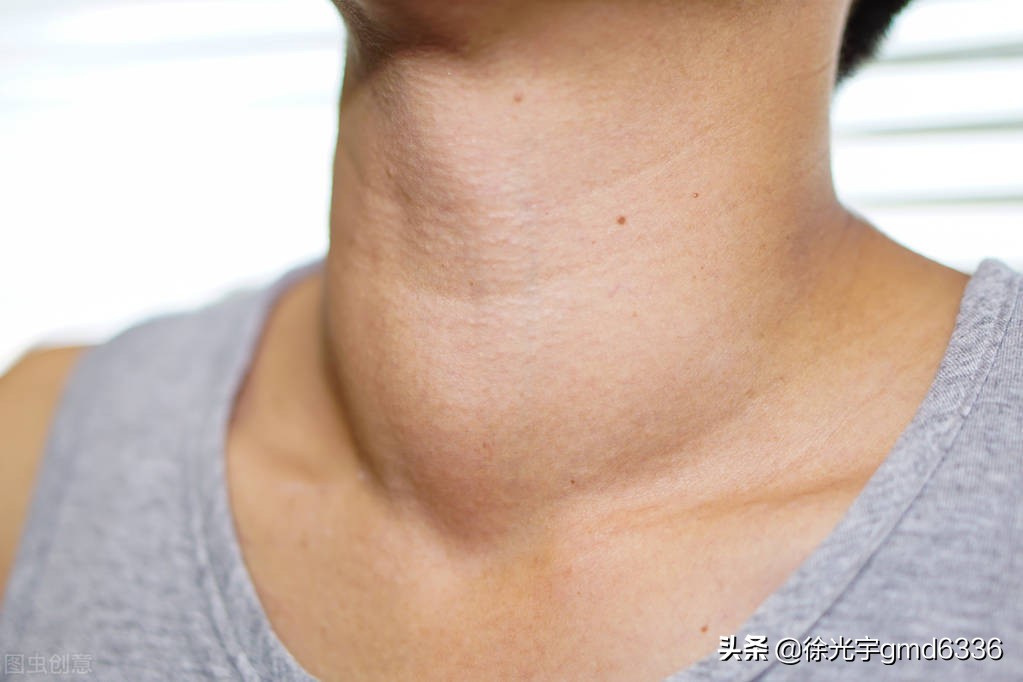 记忆力下降和甲状腺有关系吗,心慌记忆力减退是颈椎引起的吗