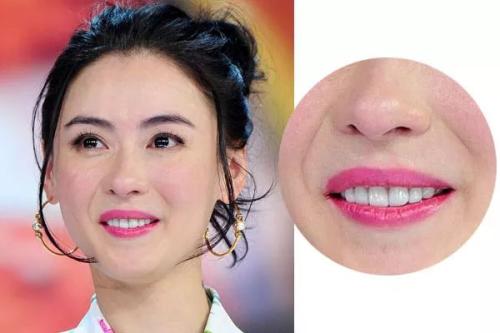 法令纹显老不用愁一招改善法令纹,减少法令纹让脸年轻的办法