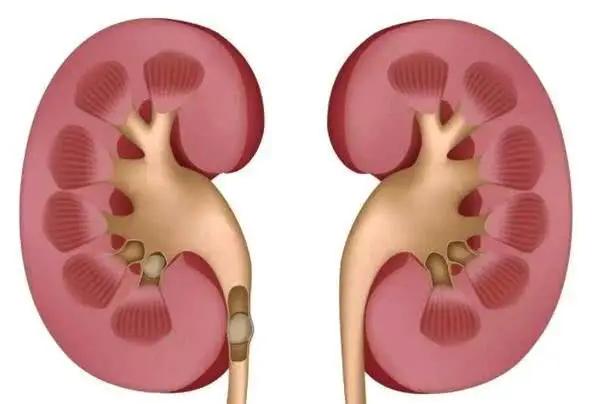 肾脏病患者要重视药物的毒副作用,药别乱吃