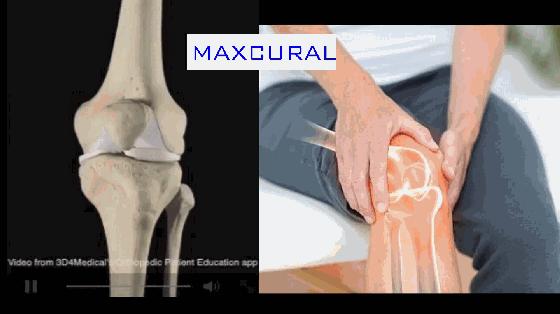 类风湿肌力锻炼,类风湿患者到底应该如何正确锻炼