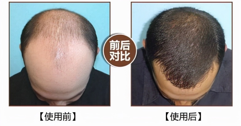 别见了胸就去点离异富婆的广告，里面全是深渊