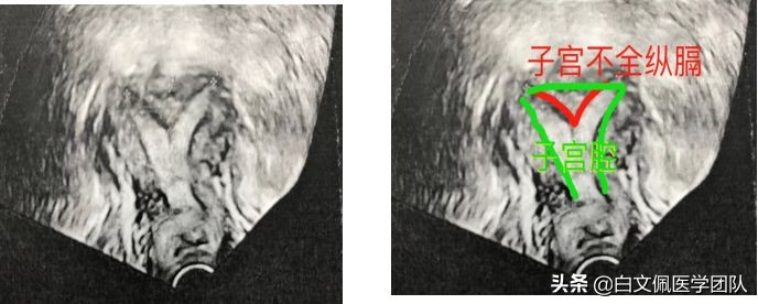 腹腔镜妇科解剖教学视频教程,白文佩医学团队