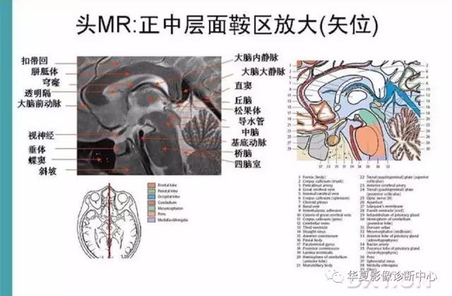 mra头颅解剖学详细讲解视频,常见的头颅mri图像