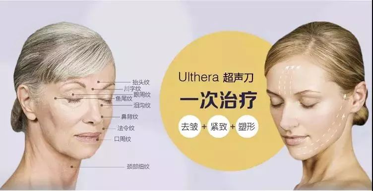 超声刀会使脸变得特饱满,超声刀能抚平皱纹吗