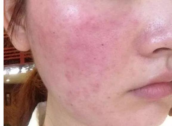 孕妇专用护肤品坑爹吗图片,孕妇护肤品真的必须专用吗