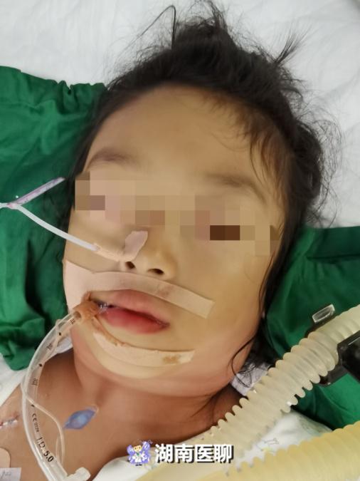 7岁女童淋巴结发炎伴有发烧,妈妈发现女儿发烧了