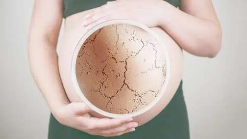 那些号称可以预防妊娠纹的乳油膏霜，原来都是智商税