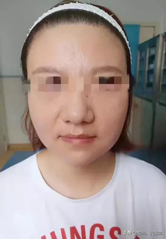 注射玻尿酸之前有什么注意事项,注射玻尿酸须知三件事