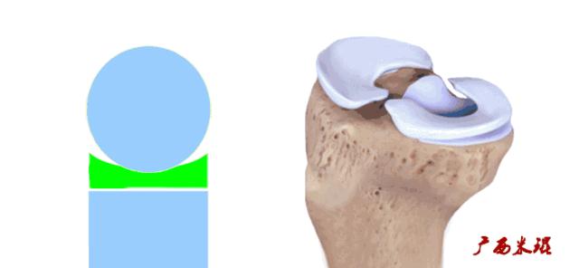 听骨科医生讲的话,听完骨科专家的一段话