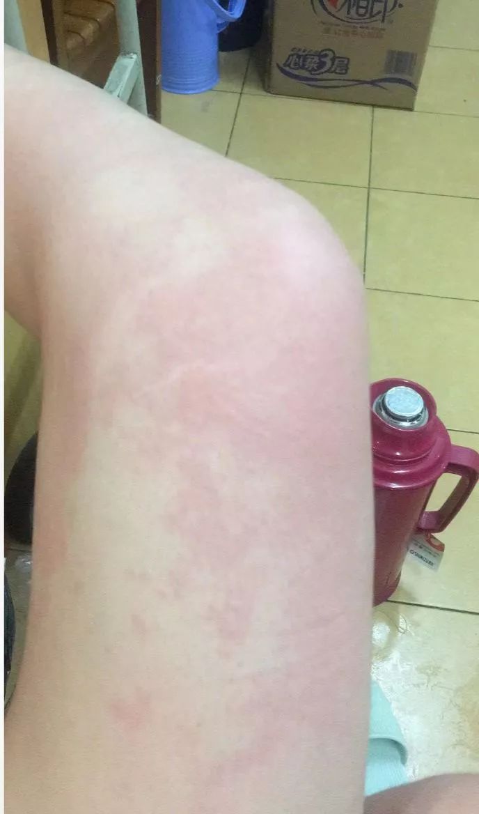 儿童春季常见疾病及治疗,当心这几类传染病近期高发