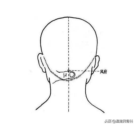 颈椎病头痛最好锻炼方法,颈椎病导致的头疼按摩哪个穴位