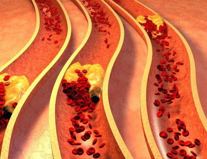 怀孕血压高吃什么水果,怀孕血压高可以顺产吗