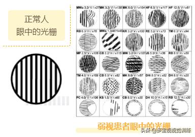 那些找不同、找圈圈的训练真的能治疗斜弱视吗？