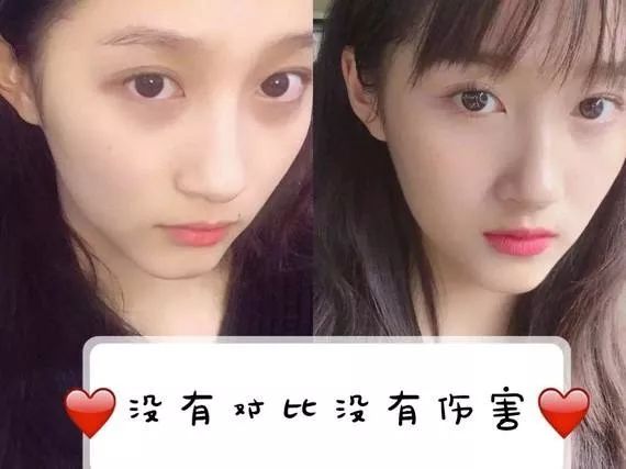 没有熬夜也有黑眼圈怎么办,没有熬夜黑眼圈怎么去除