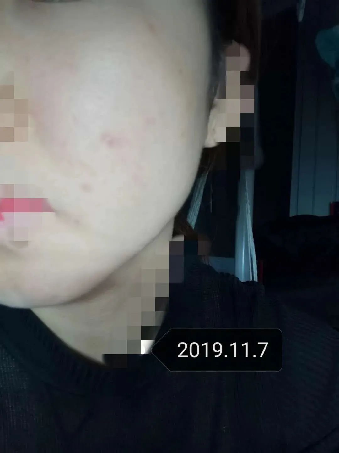 用大牌化妆品真的不会老吗,用大牌护肤品皮肤还是不好