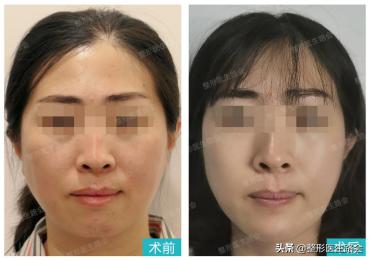 好看的下巴有哪些,好看的下巴