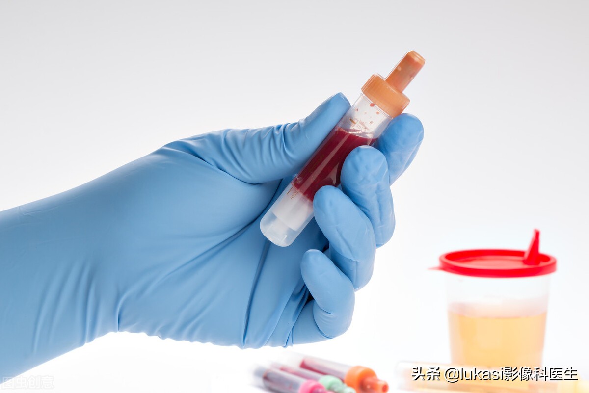 一个女同志尿血意味着什么病,女的尿血意味着什么