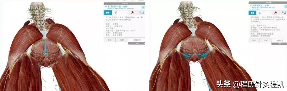 医师分享:什么是盆底肌,它在哪里?