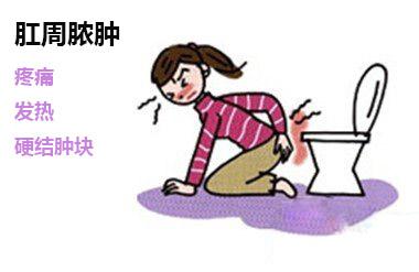 肛周脓肿健康宣教,肛周脓肿术后腹泻危害