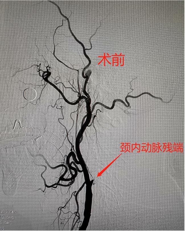 老人家突然浑身无力讲话不清楚,家中老人全身乏力是什么原因