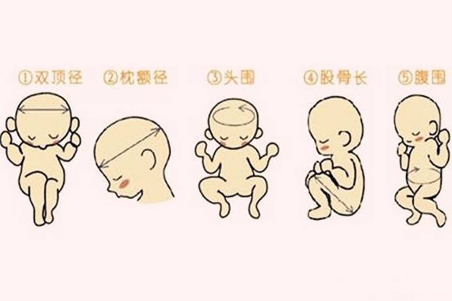 孕期看宝宝照片管用吗,孕期四维彩超看五官