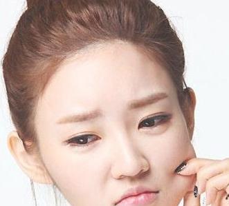 额头上长痘的原因和治疗方法,额头反复长痘的缓解方法