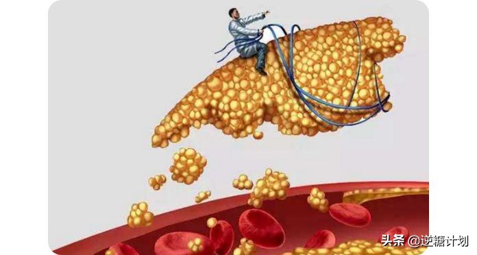 动脉粥样硬化心脏病吃什么保健品,脑动脉硬化血糖高冠心病