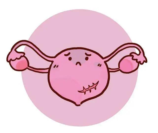 自然分娩PK剖宫产，哪种分娩方式好？