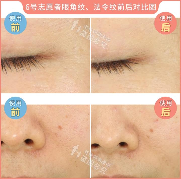 300块的网红美容仪有效果吗,网红家用美容仪测评