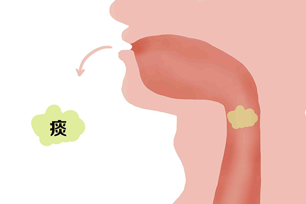 痰液颜色黄黄的,是怎么回事?