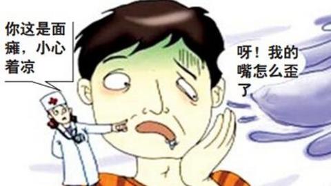 中医治疗面瘫后遗症的特效方,治疗面瘫中医好还是西医好