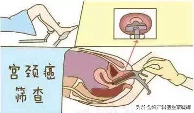 打完HPV疫苗，还有必要做宫颈癌筛查吗？
