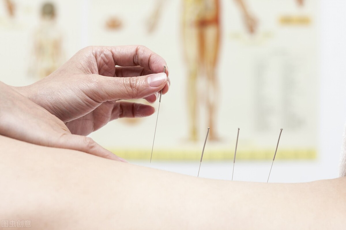 养生保健场所针灸算非法行医吗,理疗馆治疗事故是非法行医吗