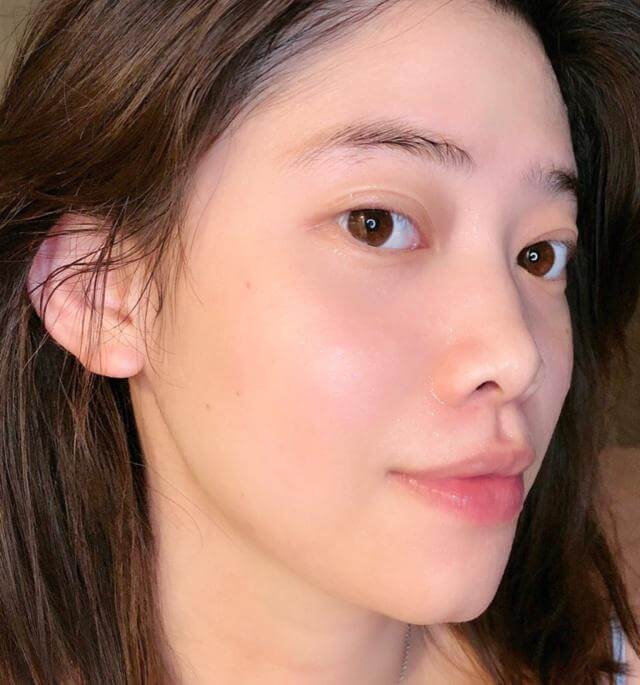 下巴反复长闭口粉刺怎么彻底去除,下巴长闭口粉刺的正确消除方法