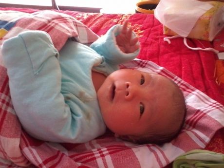 2个月女婴有白垢并发臭,两岁女宝宝有异味痒