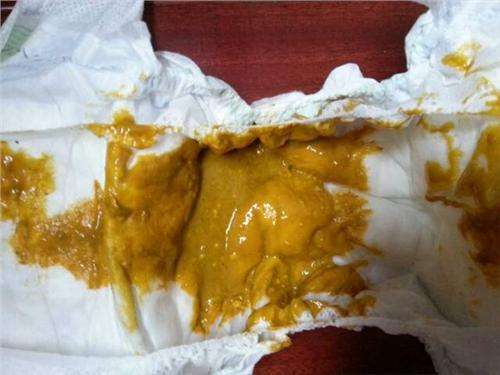 宝宝腹泻教你一招搞定,宝宝腹泻怎么才能彻底治愈