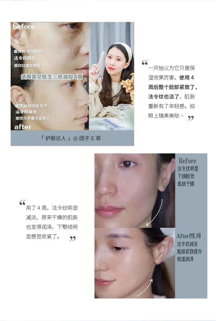 医美高端抗衰型水光针有哪些,便宜又有效果的医美抗衰项目